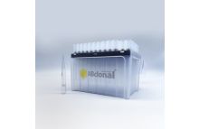 Sterile DNase/RNase-free Low Retention Filtered Pipette Tip 1000μL 